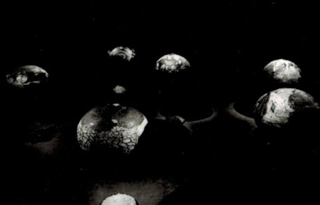 Myopia b/w